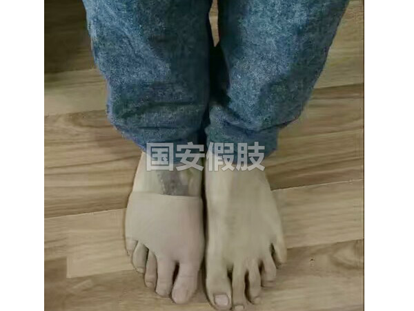 長沙國安假肢康復用品有限公司,長沙假肢用品,國安假肢康復用品,假肢矯形器,康復器材,假肢配件,矯形器支具
