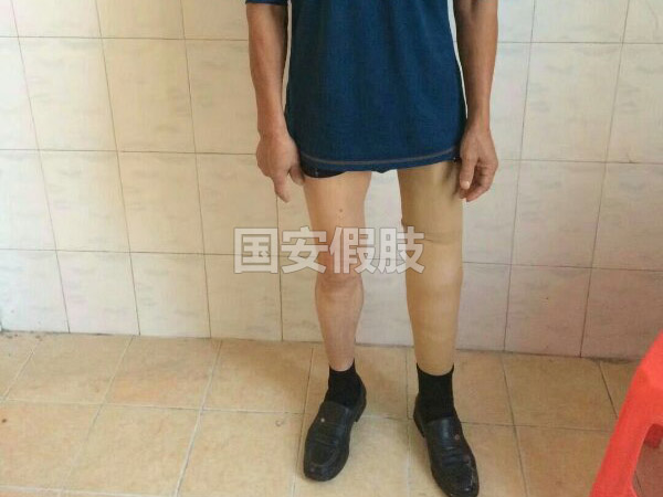 長(zhǎng)沙國(guó)安假肢康復(fù)用品有限公司,長(zhǎng)沙假肢用品,國(guó)安假肢康復(fù)用品,假肢矯形器,康復(fù)器材,假肢配件,矯形器支具