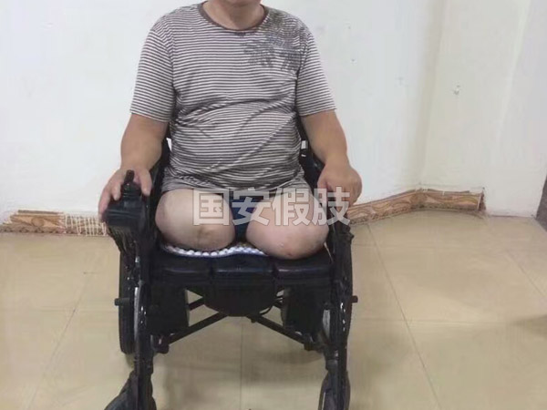 長沙國安假肢康復(fù)用品有限公司,長沙假肢用品,國安假肢康復(fù)用品,假肢矯形器,康復(fù)器材,假肢配件,矯形器支具